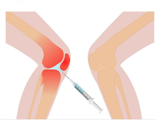 Mesotherapy Solution แก้ปวดเข่า 3 มล. กรดไฮยาลูโรนิกชนิดเชื่อมขวาง