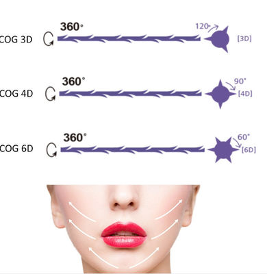 Medical PDO Pcl Nose Thread Lift การดูแลผิว การร้อยไหมกระชับ การรักษาผิวหนัง