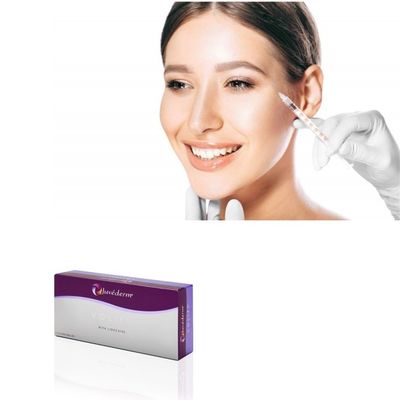 1.0ml เจลเติมความจุลิน Juvederm Voluma เพื่อเติมรอยกลากและเส้น