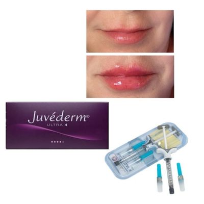 ระยะเวลา 6-9 เดือน Juvederm Dermal Filler Gel สําหรับการซื้อออนไลน์และในร้านค้า
