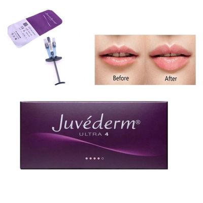 Allergan Juvederm Dermal Filler Injection Ultra4 กับ ลีโด