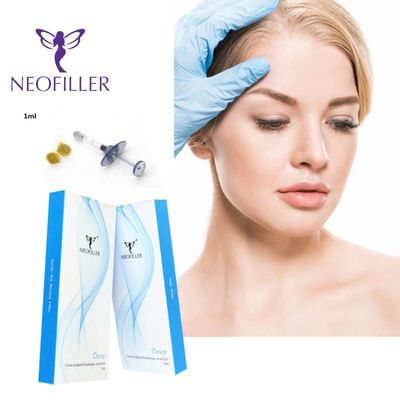 Neofiller 24mg/ml เครื่องเติมกรดไฮยอลูรอนิกที่เชื่อมต่อกันสําหรับฉีดหน้า