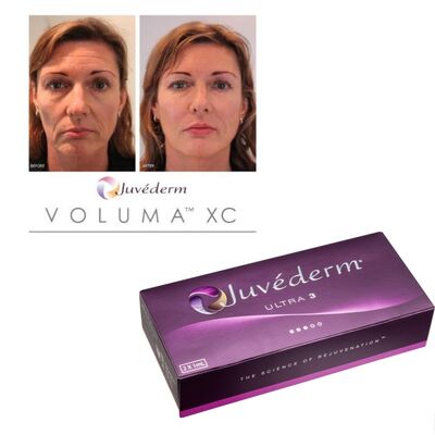 ผลิตภัณฑ์เสริมความงาม Juvederm ชนิดเจล ความเข้มข้น 20 มก./มล. ออกแบบมาสำหรับการศัลยกรรมตกแต่งและการรักษาลดริ้วรอย