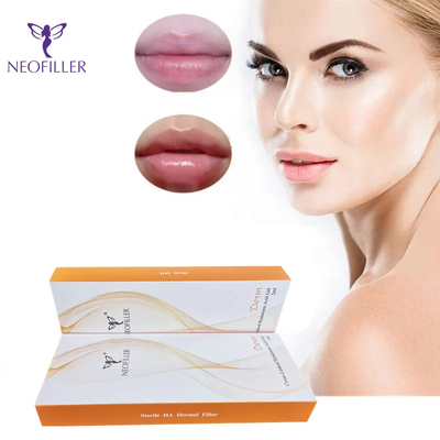 Facial Rejuvenation Facial Filler with Cross Linked Hyaluronic Acid Supports Natural Skin Regeneration