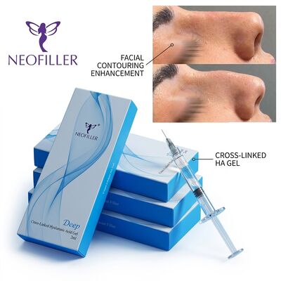 สายลึก Anti- รอย ไฮยอลูรอนิกกรด Dermal Filler เจลฉีด ขยายริมฝีปาก การฟื้นฟูปริมาณหน้า