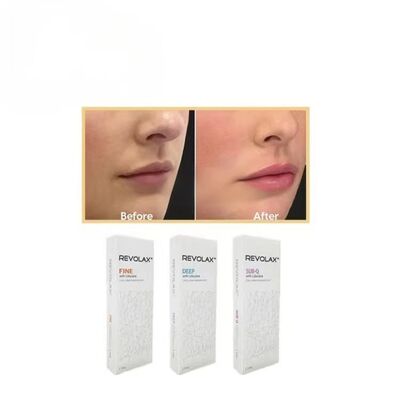 เครื่องเติมผิวหนัง Sub-Q Revolax ละเอียดลึก มีความคล่องคล่องและยืดหยุ่นสําหรับการฟื้นฟูปริมาณผิวหน้าที่ดูธรรมชาติ