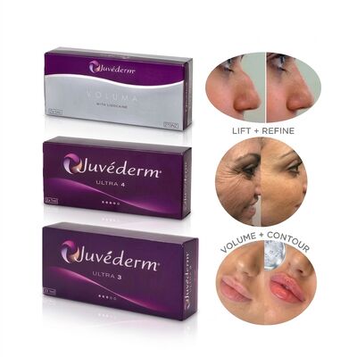 Juvederm Ultra 4 Nose Filler Hyaluronic Acid Dermal Filler สําหรับการตัดจมูกแบบไม่ผ่าตัด การเปลี่ยนรูปร่างจมูก