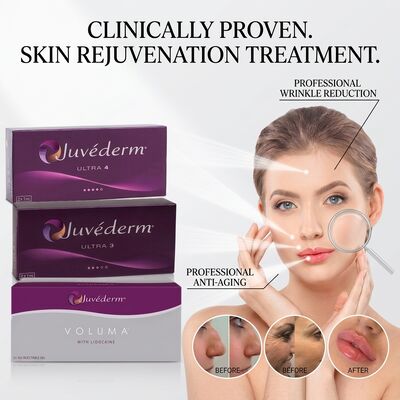 ฟิลเลอร์ Juvederm Ultra 3 ร่องแก้ม กรดไฮยาลูรอนิก ฟิลเลอร์ผิวหนังเพื่อลดเลือนริ้วรอยรอยยิ้ม 24 มก./มล.