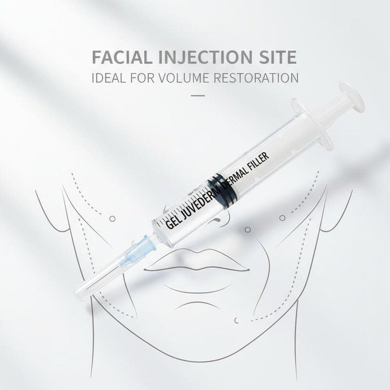 เจล Juvederm Dermal Filler 1 มล. บริเวณฉีดเข็มฉีดยาบนใบหน้าเหมาะสำหรับการฟื้นฟูผิวหน้าและขั้นตอนการฟื้นฟูปริมาตร