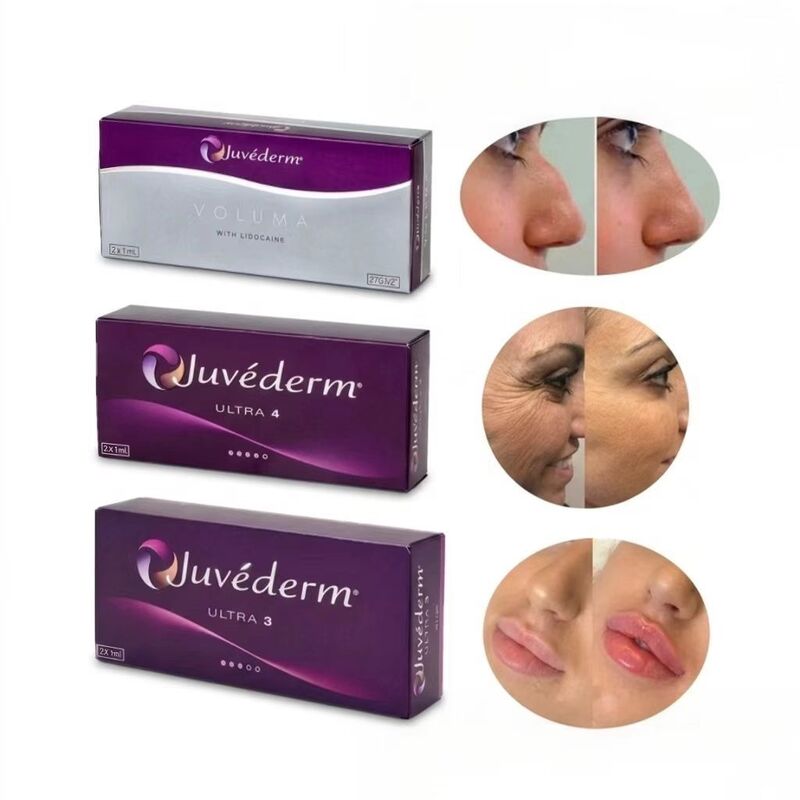 24มก./มล. ฟิลเลอร์ริมฝีปาก Juvederm Juvederm Ultra3 Ultra4 Voluma แบบฉีดได้
